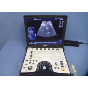 GE LOGIQ E ЦИФРОВОЙ ПОРТАТИВНЫЙ УЗИ СКАНЕР